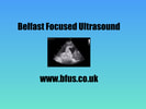 Belfast Focused Ultrasound